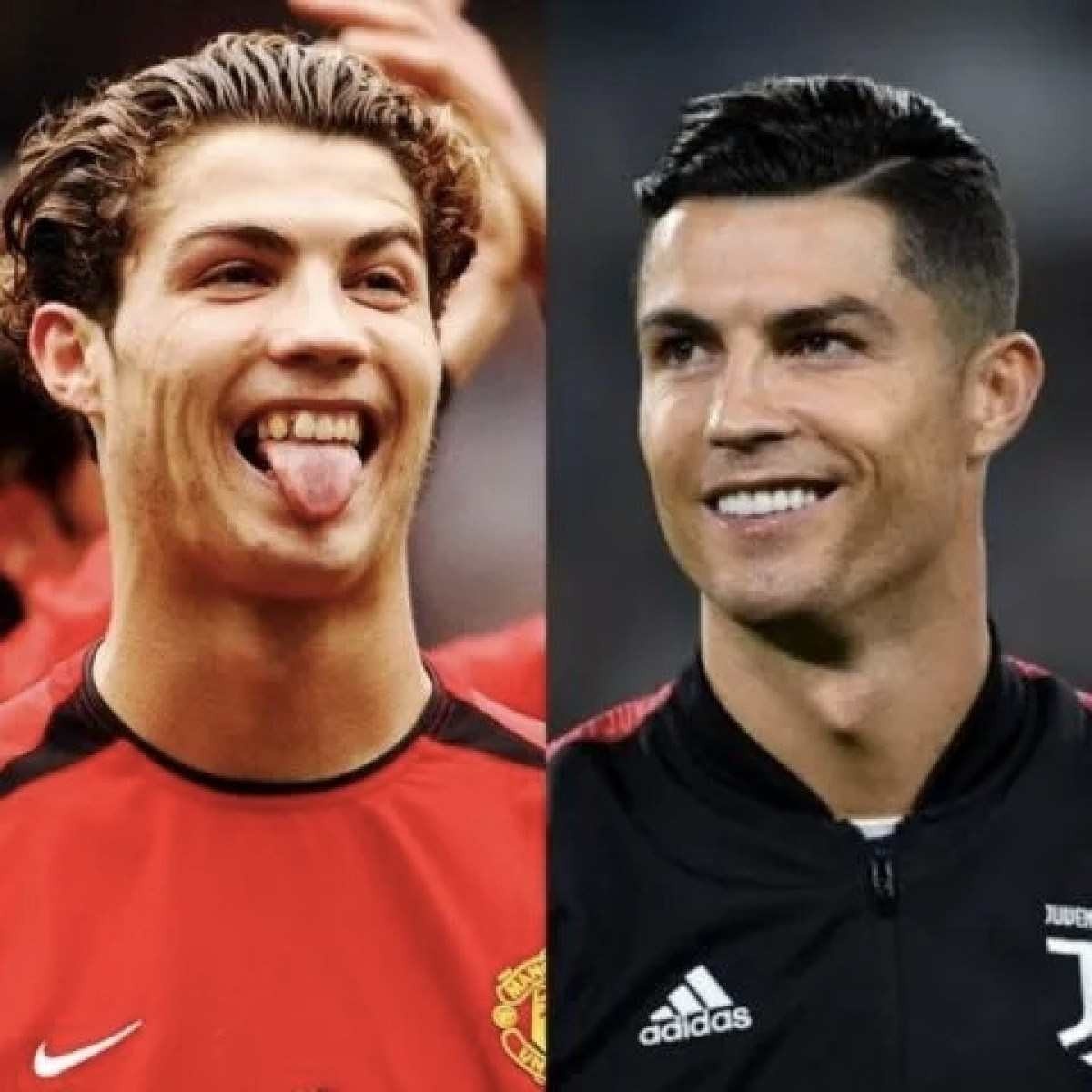 O antes e depois do sorriso de Cristiano Ronaldo 