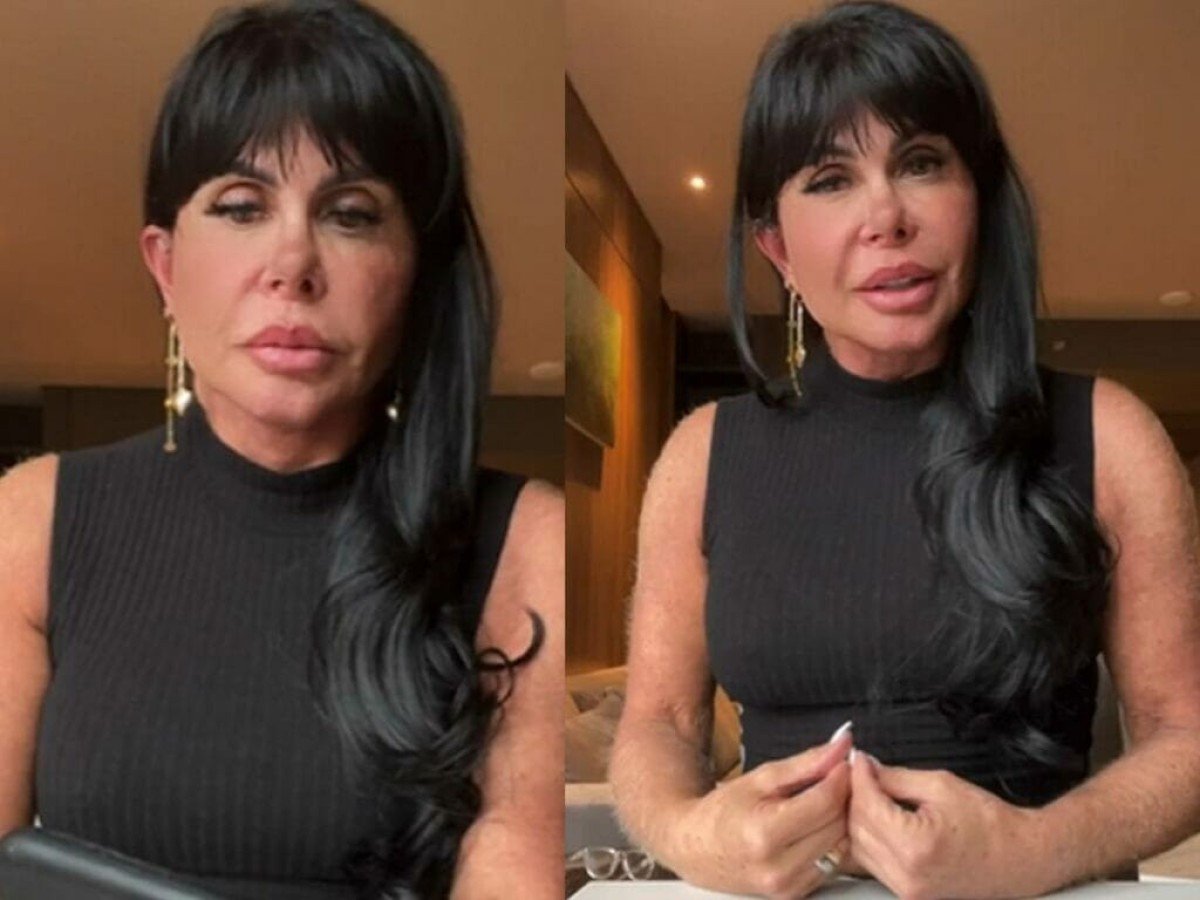 Gretchen choca ao mostrar tratamento contra queda de cabelo na web