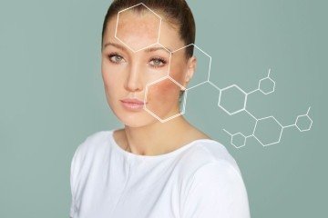 As manchas do melasma podem estar ligadas a alterações hormonais e ser desencadeadas pela luz solar (Imagem: LADO | Shutterstock) -  (crédito: EdiCase)