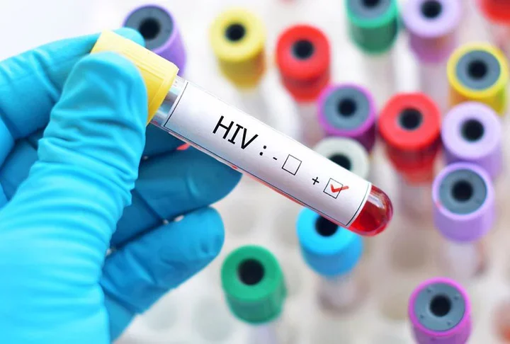 A companhia norte-americana de imunologia Vir Biotechnology informou nesta semana que uma nova vacina experimental contra o vírus da imunodeficiência humana (HIV) começa a ser testada em humanos. -  (crédito: PRess Serbia - Flickr)