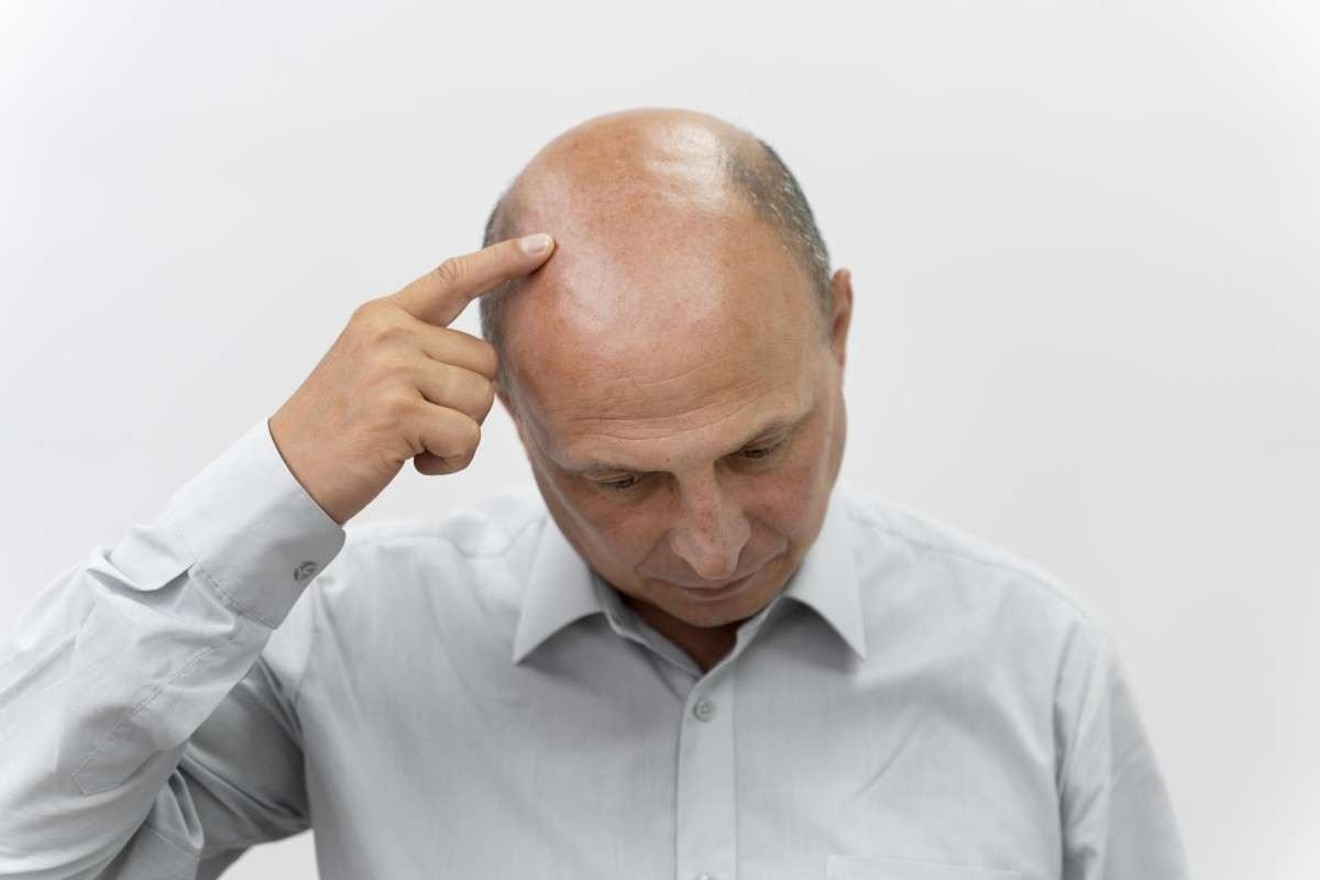 Fim dos carecas? Cientistas criam produto que faz o cabelo voltar a crescer