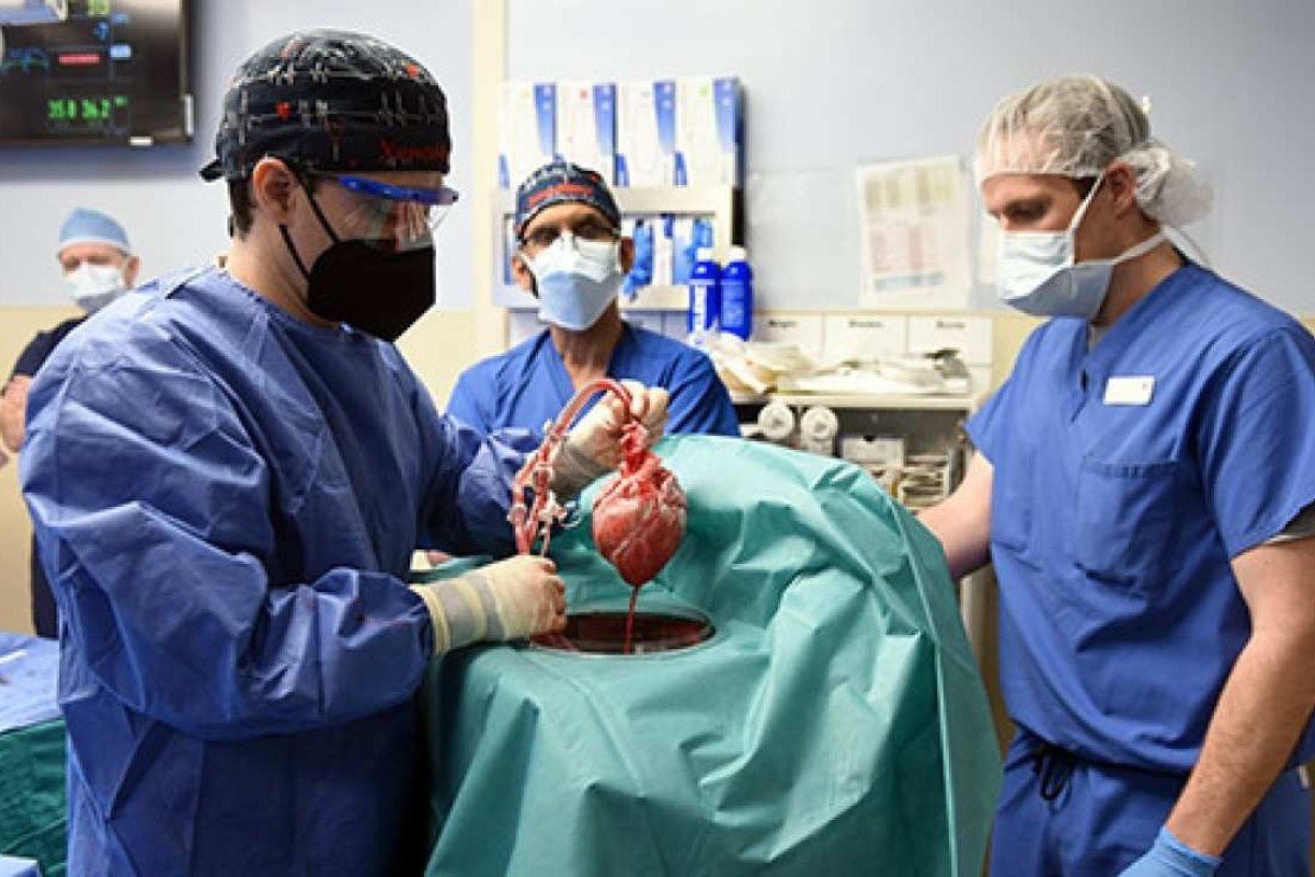 1_heart_transplant_surgery2-33205983 Transplante de Órgãos: Salvando Vidas e Transformando Futuros