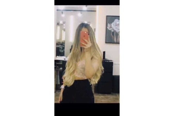 A jovem Heloísa Cristina Heliodoro, de 17 anos, perdeu 80% do couro cabeludo enquanto andava de kart, no último domingo (10/12)
- (crédito: Material cedido ao Correio ) A jovem Heloísa Cristina Heliodoro, de 17 anos, perdeu 80% do couro cabeludo enquanto andava de kart, no último domingo (10/12)
- (crédito: Material cedido ao Correio )