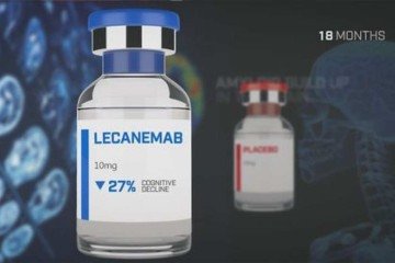 Liberado nos Estados Unidos, o lecanemabe foi testado em 1,7 mil pessoas e mostrou-se eficiente em retardar o avanço do Alzheimer em estágio inicial - (crédito: Alzheimers´Research/Divulgação ) Liberado nos Estados Unidos, o lecanemabe foi testado em 1,7 mil pessoas e mostrou-se eficiente em retardar o avanço do Alzheimer em estágio inicial - (crédito: Alzheimers´Research/Divulgação )