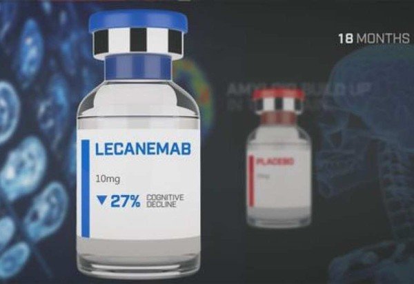 Alzheimers´Research/Divulgação