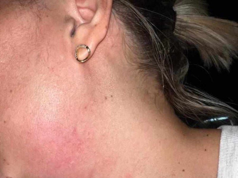 Mãe agredida por sargento do CBMDF ao defender o filho vai pedir medida protetiva