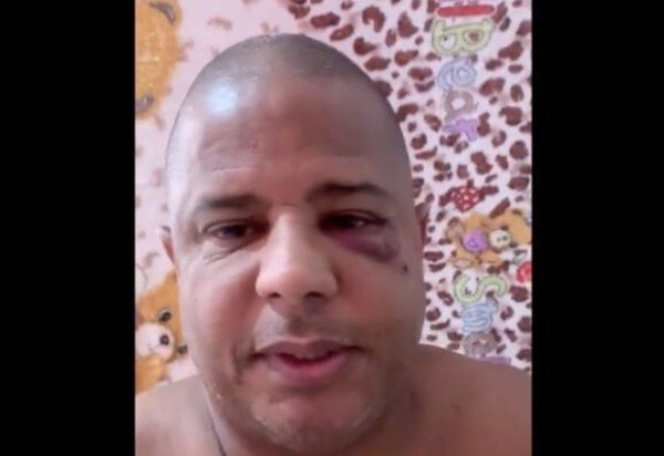 Foto: Reprodução/Redes sociais