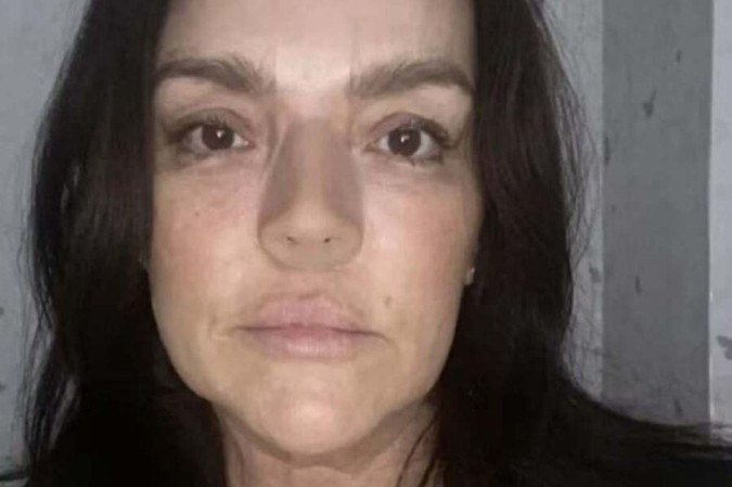 Atualmente, Lisa Mercer utiliza uma prótese magnética que precisa ser limpa três vezes ao dia -  (crédito: Arquivo pessoal)