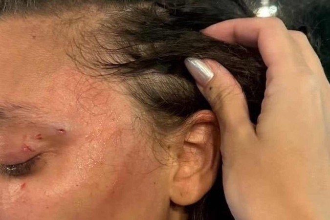 A mulher foi agredida com um soco no rosto na saída do banheiro -  (crédito: Arquivo pessoal)