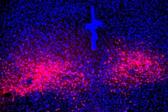 Peptídeos PACAP expressos (vermelho) no cérebro de ratos com modelo de síndrome do pânico