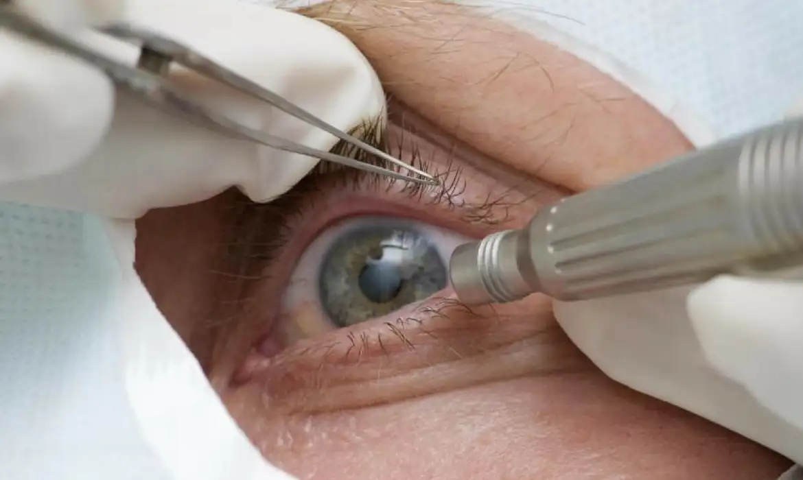 Mudar a cor dos olhos? Médicos alertam para riscos de cirurgia - EBC - Últimas Notícias