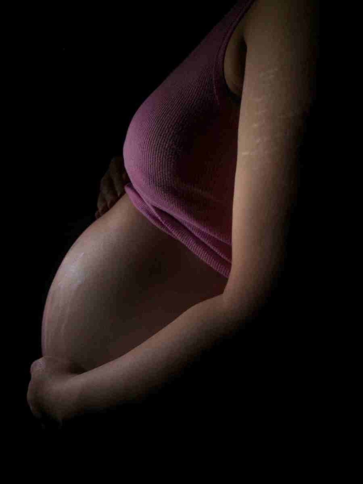 Mulheres na gravidez tendem a ter mais estrias Mulheres na gravidez tendem a ter mais estria