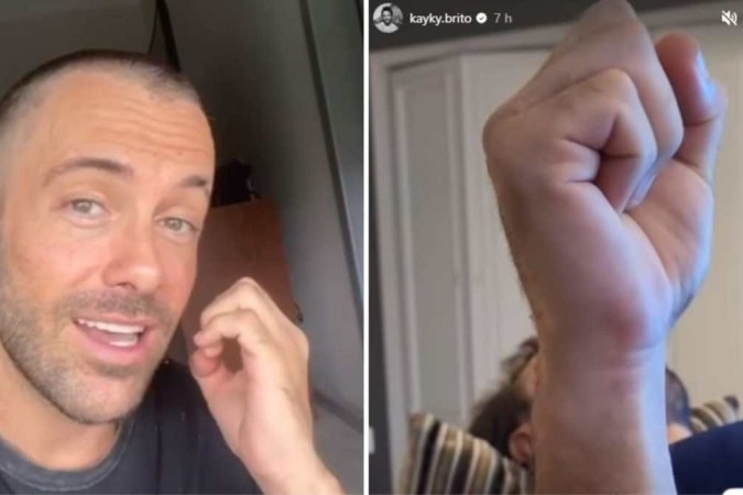 O ator ficou internado por 27 dias e passou por uma cirurgia de fixação de fratura da pelve e do braço direito -  (crédito: Kayky Brito/Instagram/Reprodução)