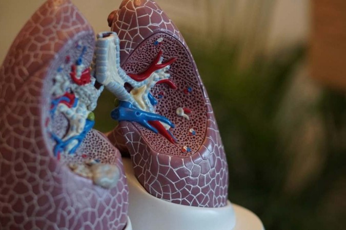 Pneumonite é uma inflamação dos tecidos pulmonares, entre elas estão: alergias, exposição a certos produtos químicos e outros -  (crédito: unsplash/ Robina Weermeijer)