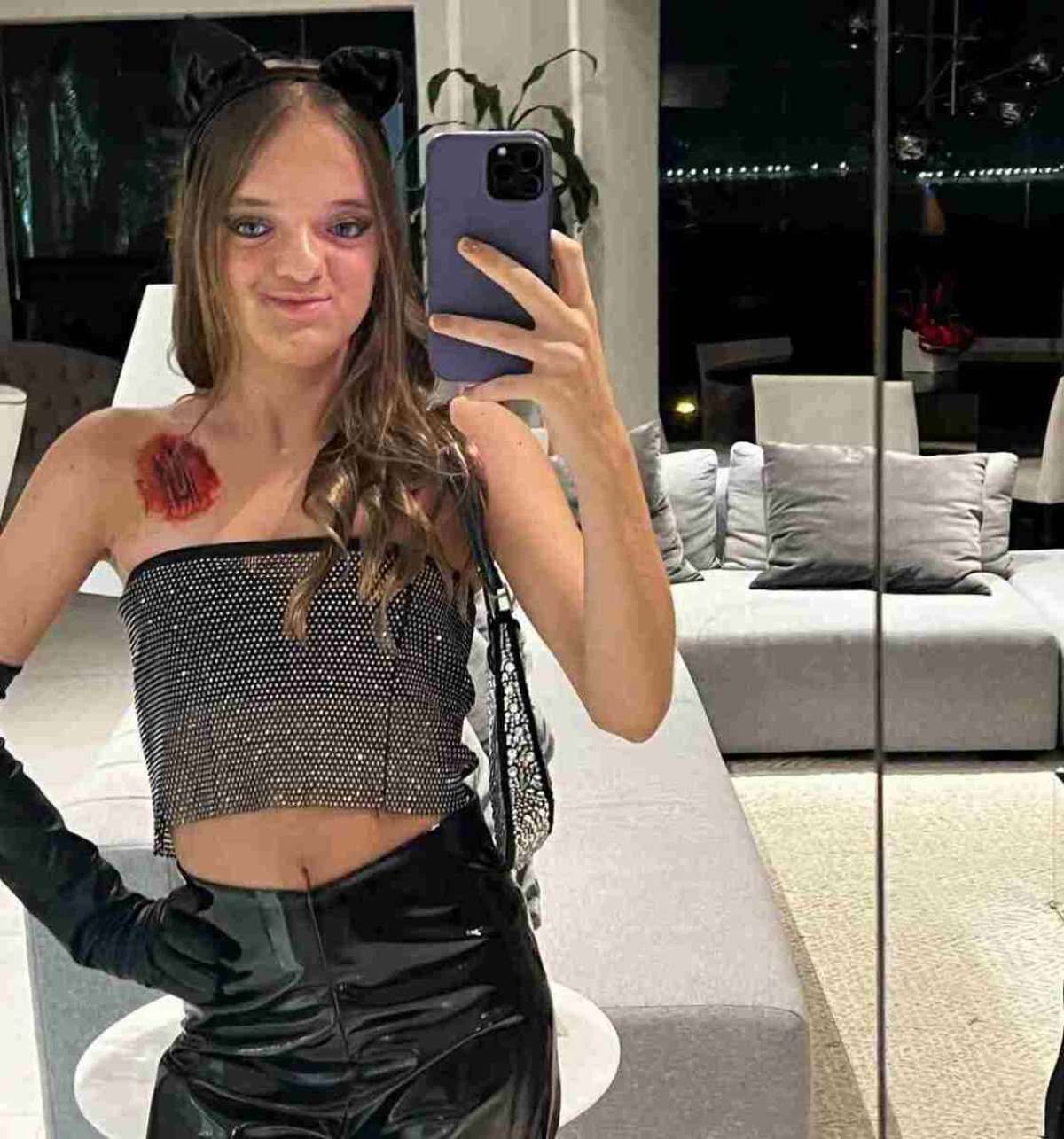 Rafa Justus posta foto após rinoplastia; Veja o resultado