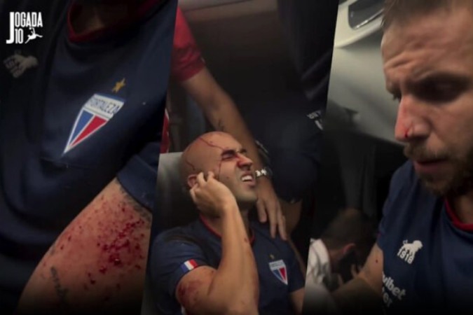 Jogadores do Fortaleza acabaram feridos em ataque, após duelo contra o Sport -  (crédito: Fotos: Reprodução Instagram @marcelopaz)