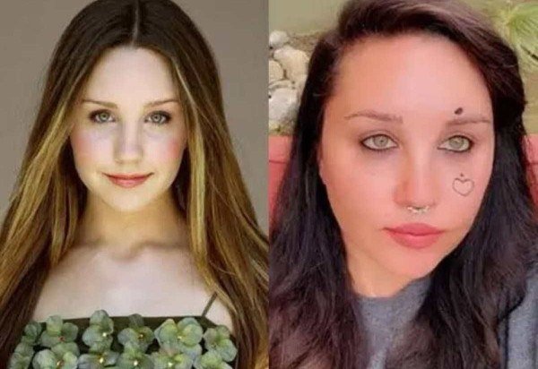 Reprodução Instagram 