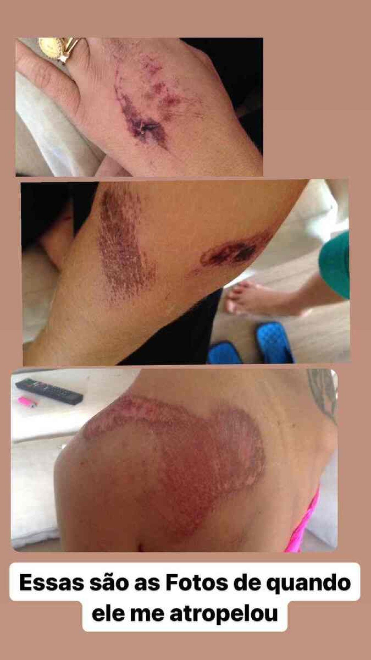 Mulher sofre agressões do ex- companheiro em Vicente Pires