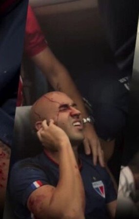 Jogadores do Fortaleza foram atingidos por pedras  -  (crédito: Foto: Reprodução de vídeo SportTV)