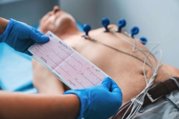Paciente sendo submetido a eletrocardiograma, exame de avaliação da atividade elétrica do coração por meio de eletrodos fixados na pele -  (crédito: Freepik)