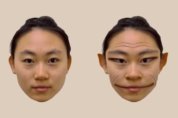 O raro distúrbio faz com que pessoas vejam rostos distorcidos  -  (crédito: Divulgação/ The Lancet)