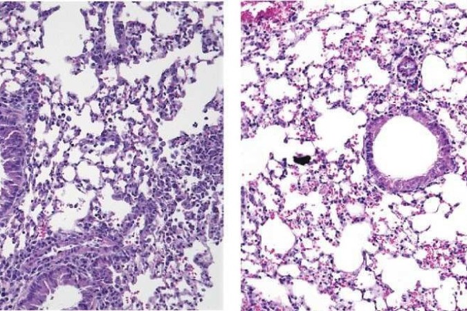  À esquerda, ativação de ILC2s causa inflamação nos pulmões de ratos, mas há redução quando aplicado o  Yoda1, à direita -  (crédito: ©2024 Hurrell et al)