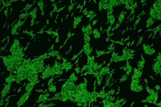 Oscillibacter sp. em forma de bastonete: as bactérias absorvem o colesterol marcado com fluorescência, mostrado em verde -  (crédito: Ahmed Mohamed)