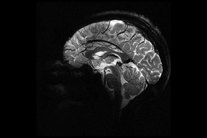 Imagem do cérebro de máquina de ressonância mais potente do mundo     -  (crédito: CEA/Divulgação)