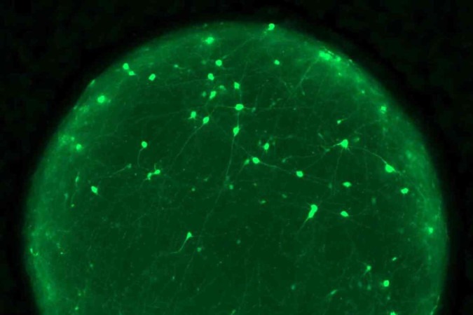 Imagem mostra os organoides com neurônios (marcados em verde) -  (crédito: Joshua Berlind/Laboratório Ichida)