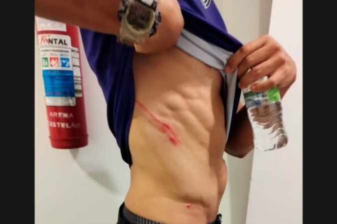 Marcas da agressão de Thiago Galhardo em funcionário do Ceará -  (crédito: Foto: Reprodução/Twitter)