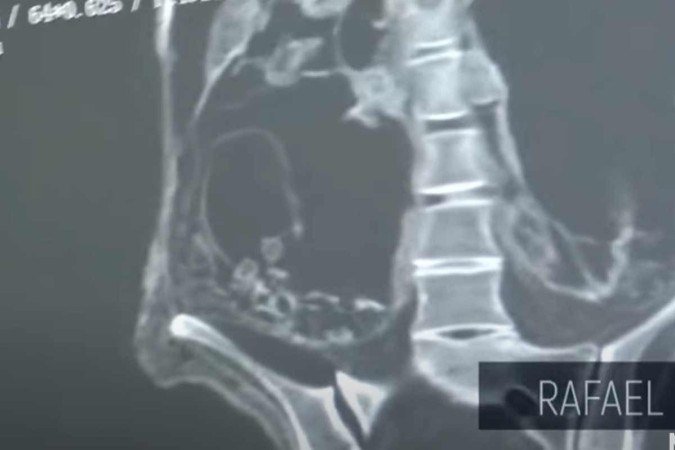 Fotos da múmia alienígena apresentadas durante a conferência