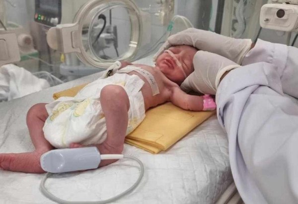 Bebê palestina, Sabreen Jouda, nasceu prematuramente depois que a mãe foi morta em um ataque israelense. -  (crédito: Mohammad Jahjouh/AP)
