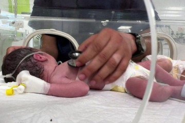 Bebê nasceu graças a uma cesariana de emergência após uma gravidez de sete meses e meio -  (crédito: Reuters)