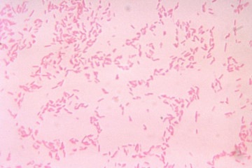 B. fragilis, na imagem ampliada, é uma das bactérias mais comuns presentes no trato gastrointestinal -  (crédito: Centers for Disease Control/V.R. Dowell Jr.)
