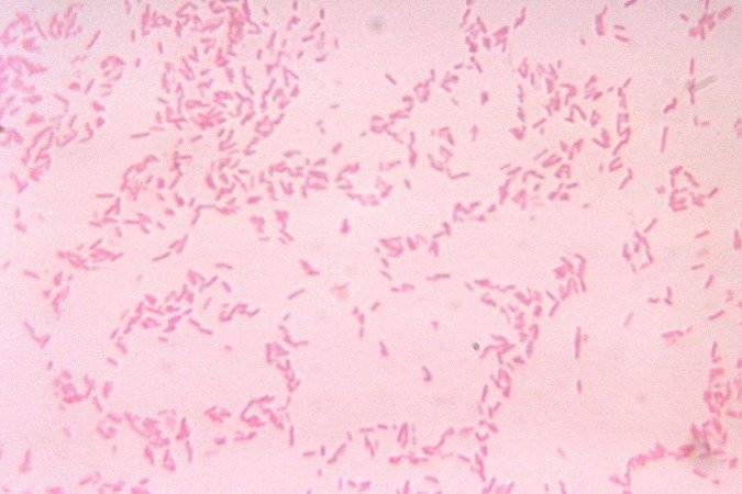 B. fragilis, na imagem ampliada, é uma das bactérias mais comuns presentes no trato gastrointestinal - (crédito: Centers for Disease Control/V.R. Dowell Jr.) B. fragilis, na imagem ampliada, é uma das bactérias mais comuns presentes no trato gastrointestinal - (crédito: Centers for Disease Control/V.R. Dowell Jr.)