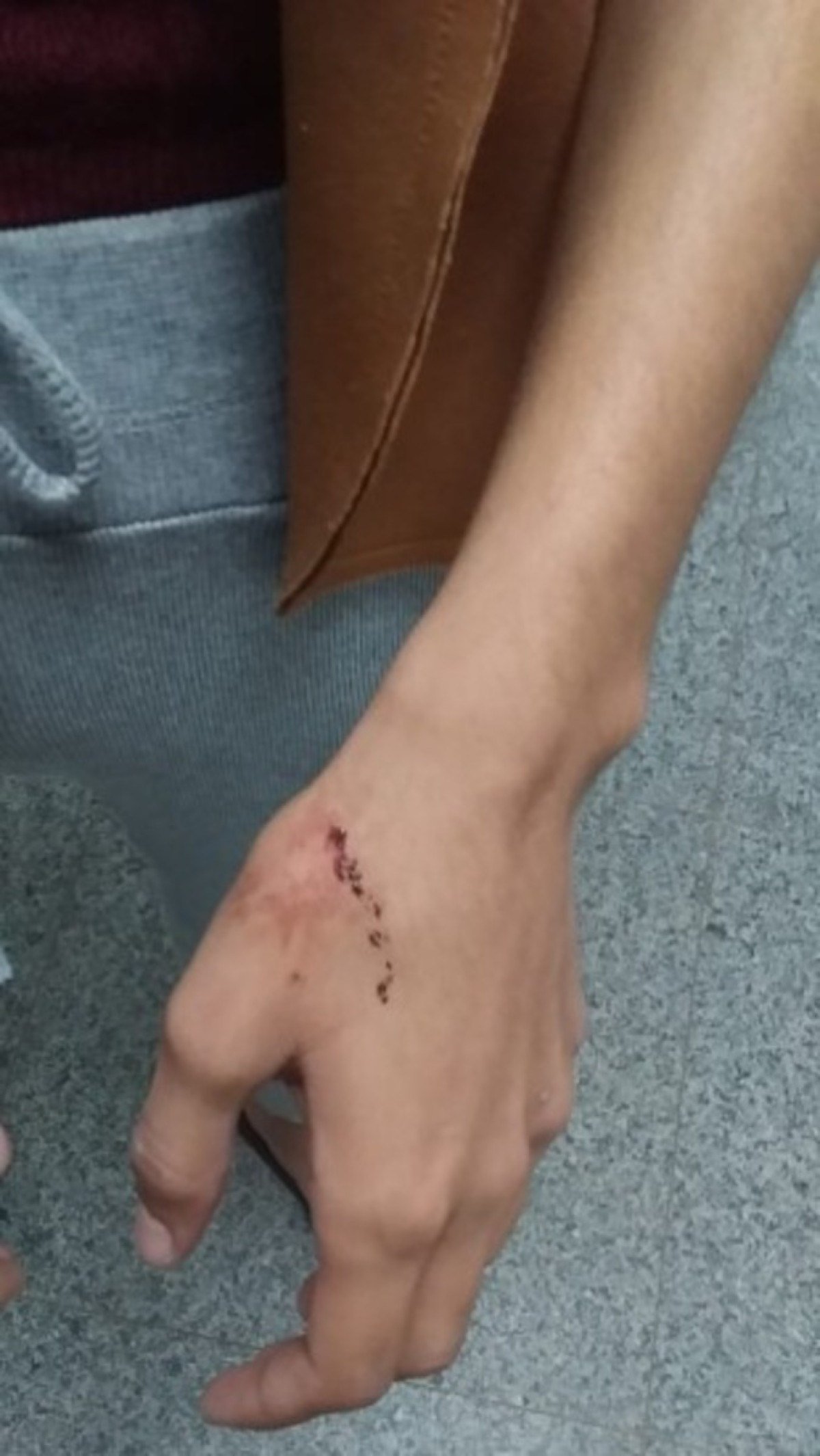 A mulher teria sido agredida pelo próprio namorado, segundo a PMDF