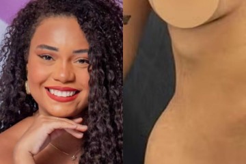 Antes e depois: Ex-BBB Thalyta Alves mostra resultado de lipoaspiração -  (crédito: Observatorio dos Famosos)
