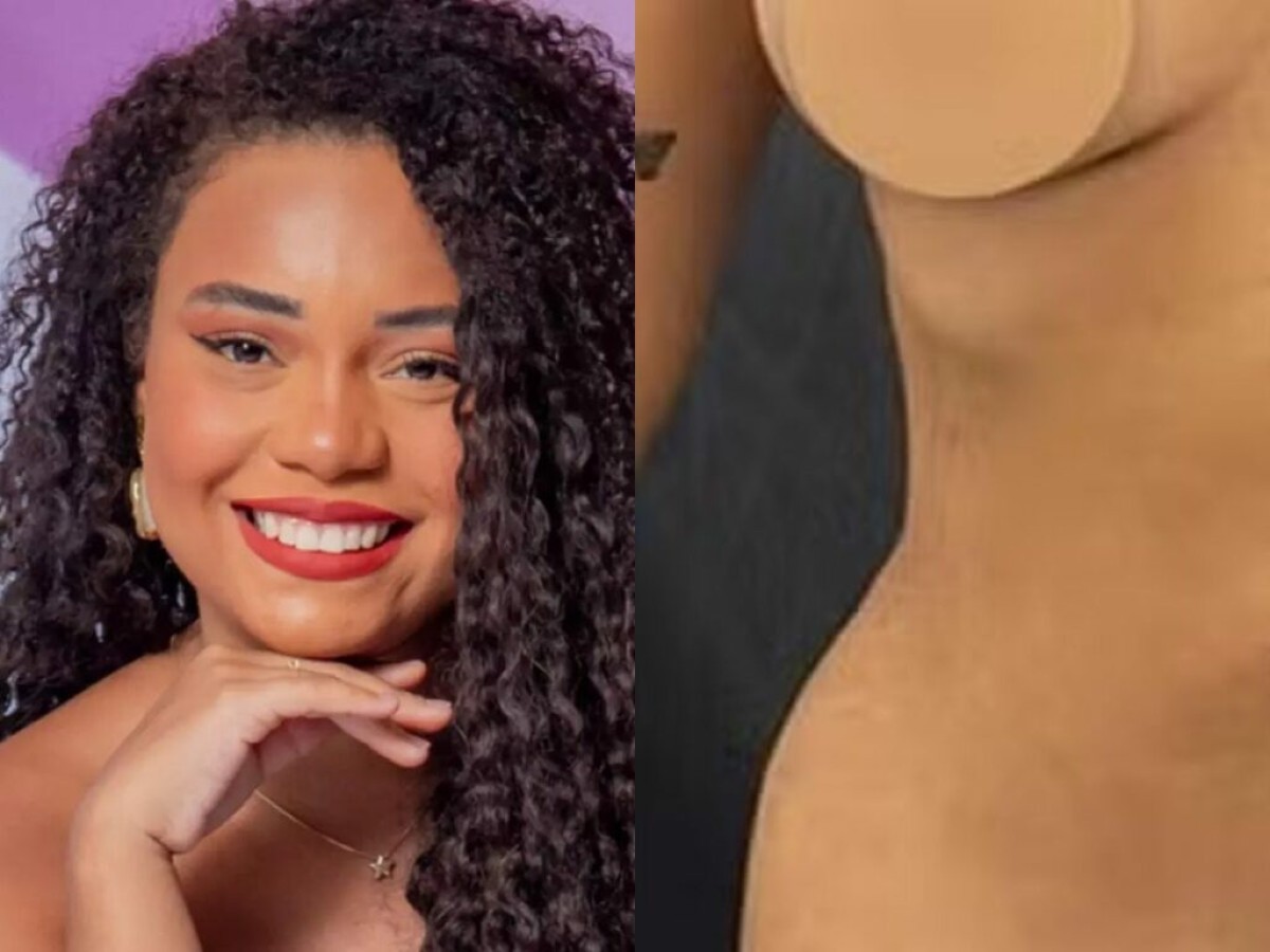 Antes e depois: Ex-BBB Thalyta Alves mostra resultado de lipoaspiração