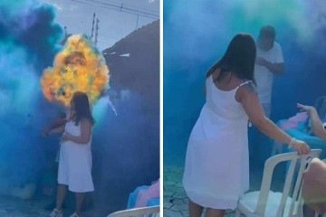 Chá revelação acaba em explosão e deixa pai ferido - Reprodução/Redes sociais