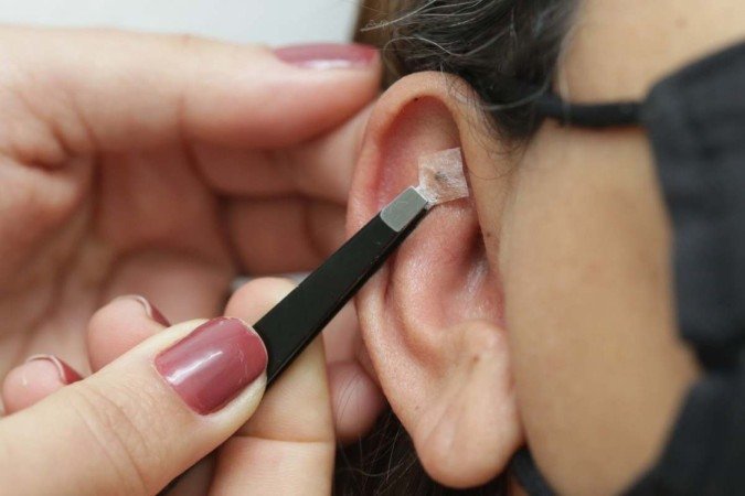 Auriculoterapia é uma opção de prática integrativa em saúde pública