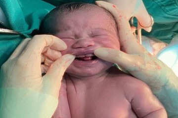 Obstetra registra caso de bebê que nasceu com seis dentes -  (crédito: Reprodução)