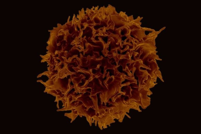 Linfócito T, componente do sistema imunológico tem função de defesa, é o alvo das terapias CAR-T -  (crédito: NIAID/Divulgação )