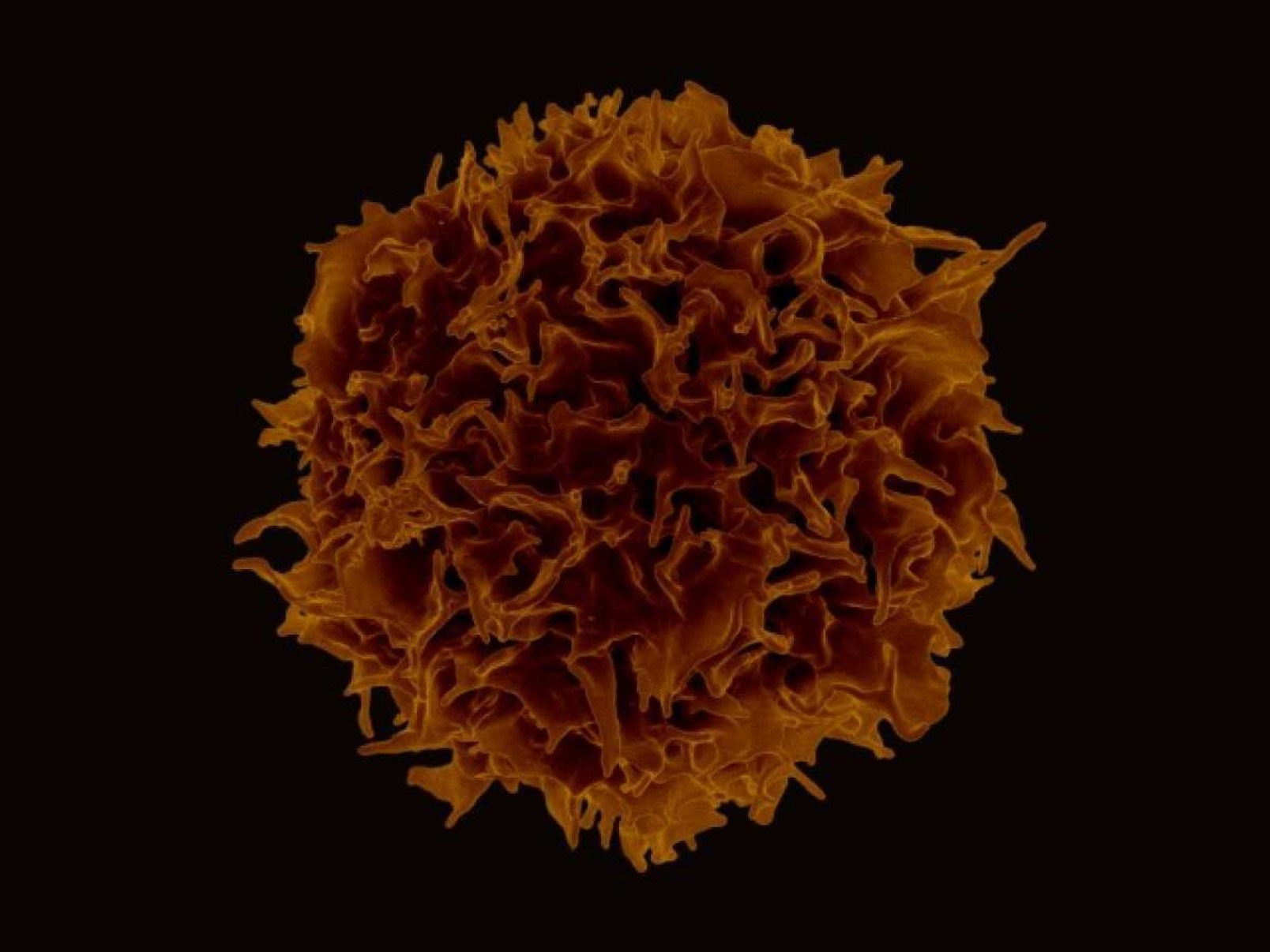 Cientistas estudam o poder de células CAR-T adaptadas contra o câncer 
