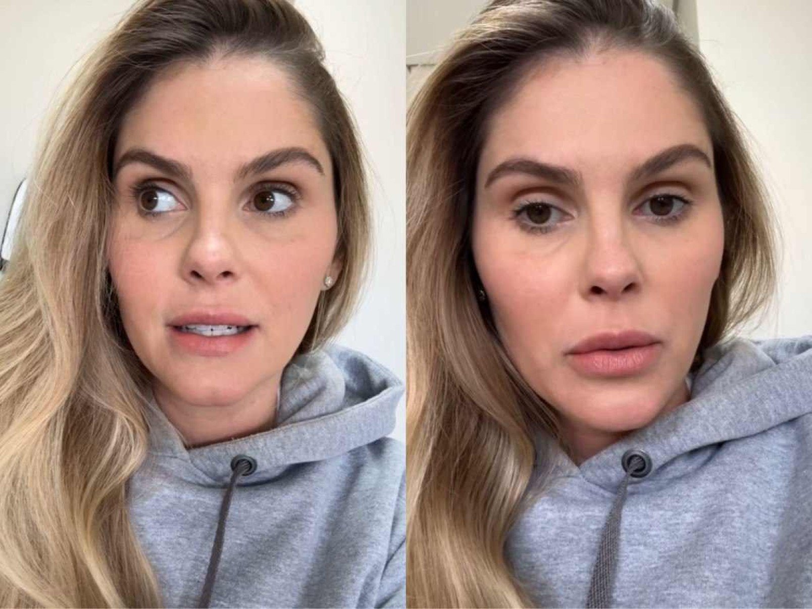 Bárbara Evans revela que filho aguarda vaga em UTI particular