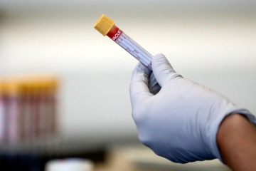 Os exames de sangue fornecem aos médicos mais informações para orientar diagnósticos e decisões de tratamento -  (crédito: Reuters)