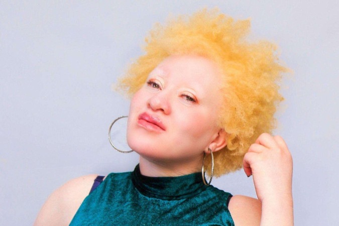 Regina diz que só conheceu os mitos que cercam o albinismo mais velha, mas que sempre sentiu ser diferente -  (crédito: Handout)