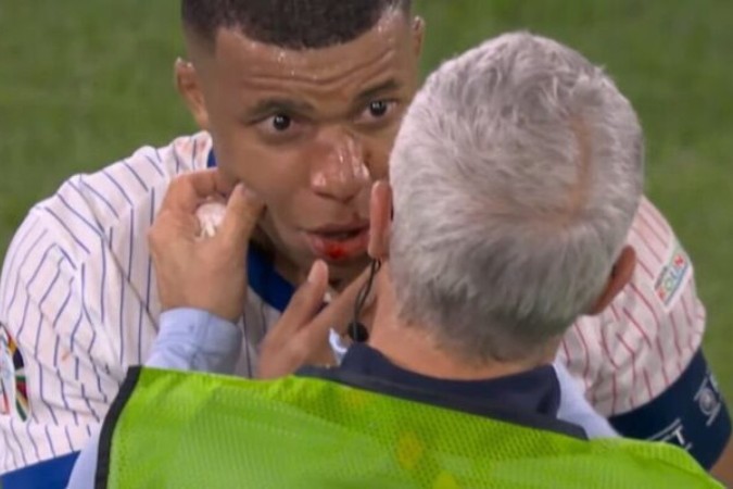 Nariz de Mbappé pode ter sido fraturado após choque com adversário - Foto: Reprodução -  (crédito: Reprodução)