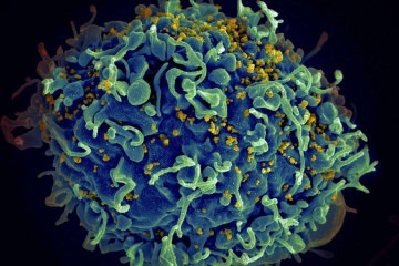 O vírus da imunodeficiência humana (HIV) é um retrovírus com capacidade de mutação muito rápida -  (crédito: National Cancer Institute/Unsplash)