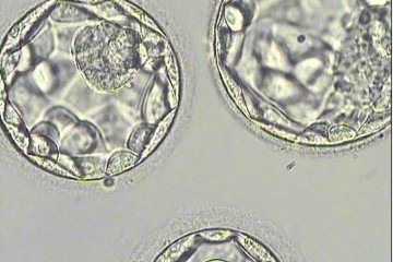 De acordo com jornais australianos, o bebê nasceu em 2024. A idade da criança e as identidades dos pacientes envolvidos não foram reveladas -  (crédito: Unidade de fertilização in vitro Shaare Zedek)