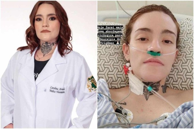 Carolina Arruda foi diagnosticada com a neuralgia do trigêmeo há 11 anos -  (crédito: Reprodução/Instagram/@caarrudar)